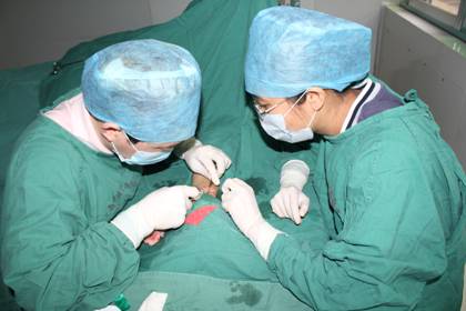 静脉-动脉化手术（动静脉内瘘形成术）