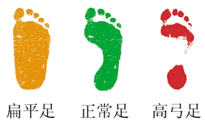 请别忽略你的脚丫子 --专家提醒家长关注儿童脚部健康，足部保健操可帮助预防足疾